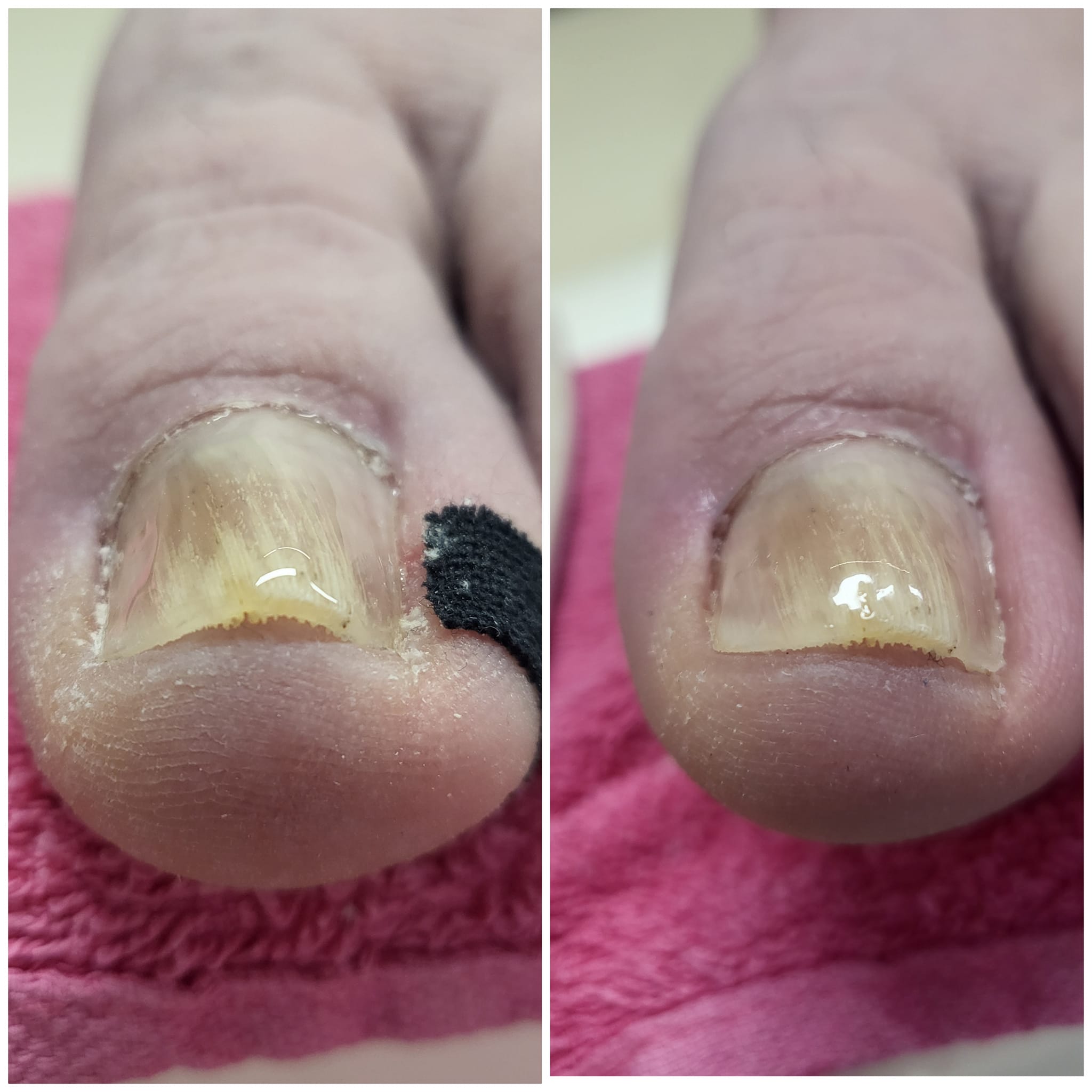 Gallery picture of LIFTUPGEL