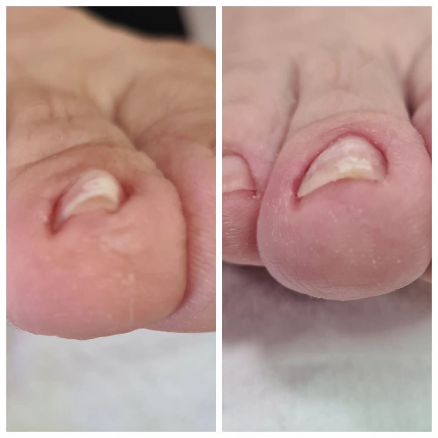 Gallery picture of LIFTUPGEL
