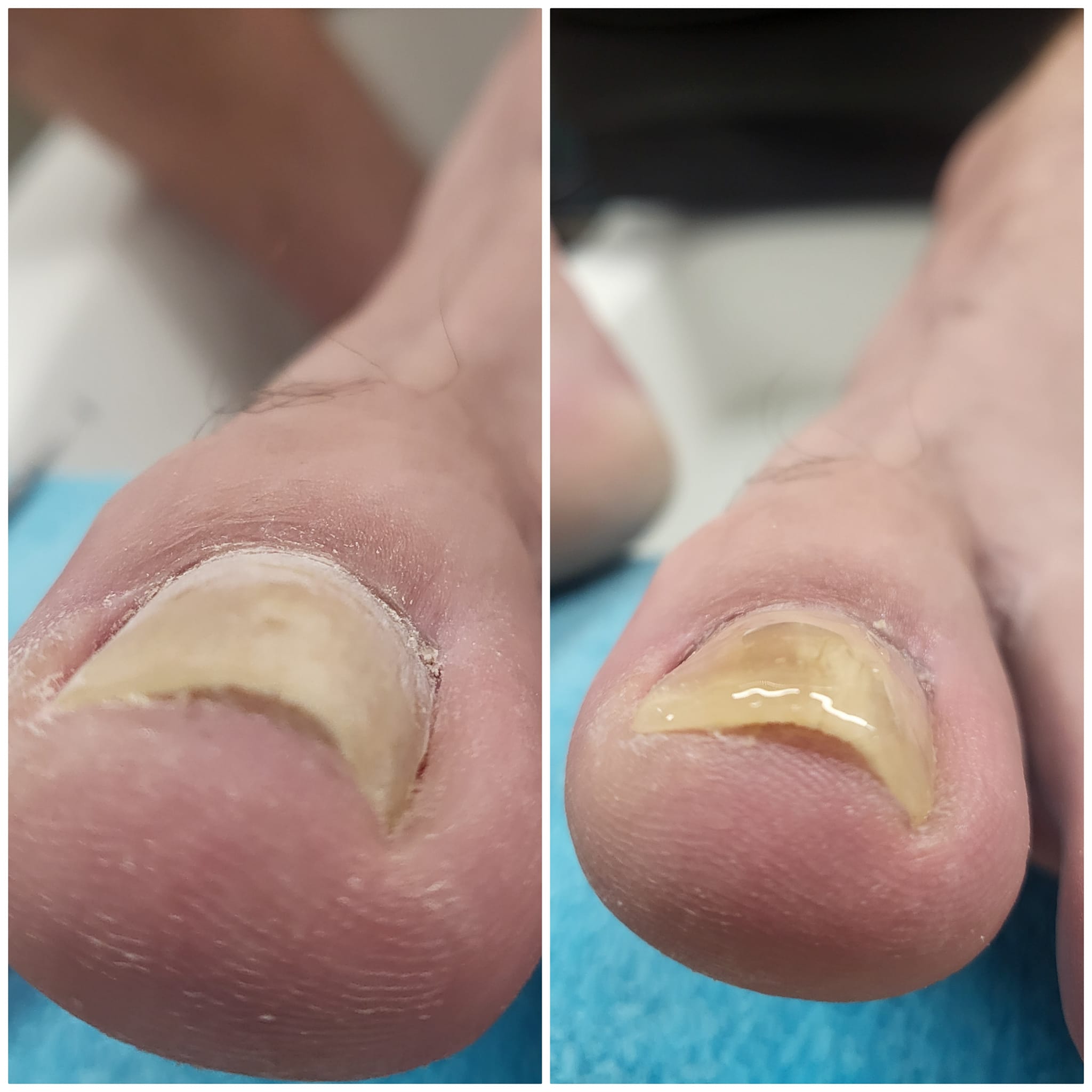Gallery picture of LIFTUPGEL